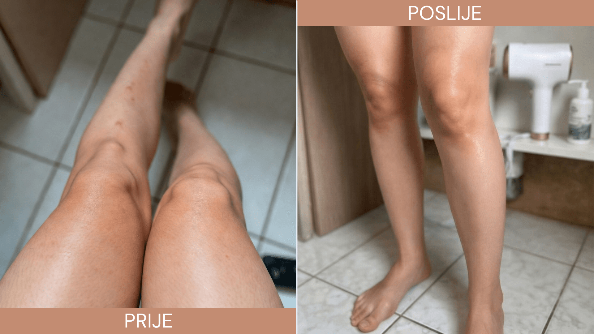 Ivana, 24 god. · Banja Luka · 8 sedmica tretmana